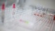View of blood tests in a hospital (file photo)